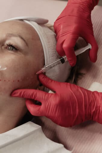 biostymulatory-tkankowe